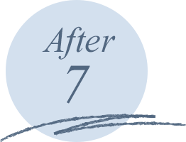 After7